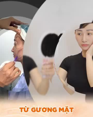 CẤY MỠ BABY - TẠO HÌNH MỀM MẠI