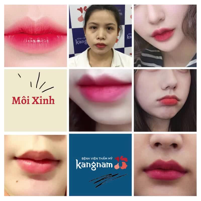 Muốn sở hữu một đôi môi đẹp hãy đến KANGNAM!