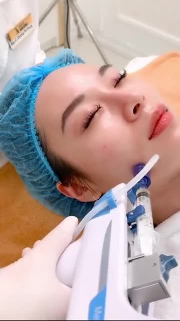Căng bóng da buổi 2