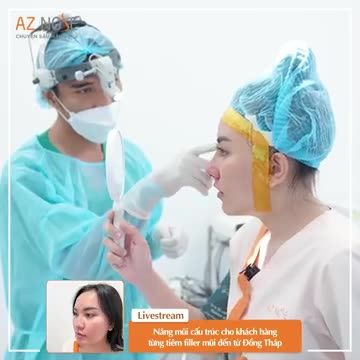 Bác sĩ CKI. Đinh Xuân Sơn Tùng nâng mũi cấu trúc cho khách hàng từng t.iêm filler đến từ Đồng Tháp.