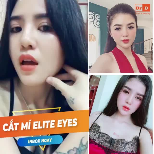 Mắt một mí, mí lẩn, mí lót, đa mí,....làm bạn mất tự tin?