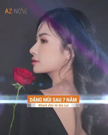 “Flex” nhẹ dáng mũi sau 7 năm của nhà AZ NOSE