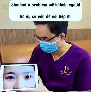 Cùng theo dõi những phân tích chuyên môn đến từ Bác sĩ của Dr.Hải Lê về trường hợp mí của vị khách hàng nhé!