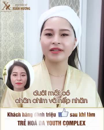 Cùng xem sự thay đổi của khách hàng với phương pháp trẻ hóa da Youth Complex, tình trạng da đã thay đổi ngay từ buổi đầu tiên: