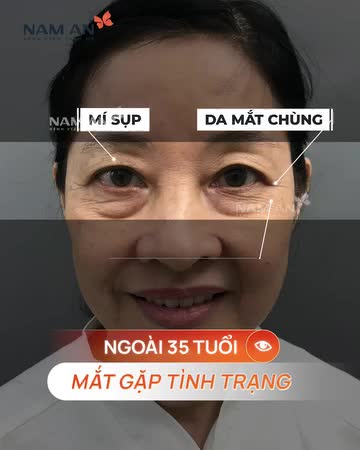 ĐỪNG ĐỂ TUỔI TÁC HẰN LÊN ĐÔI MẮT