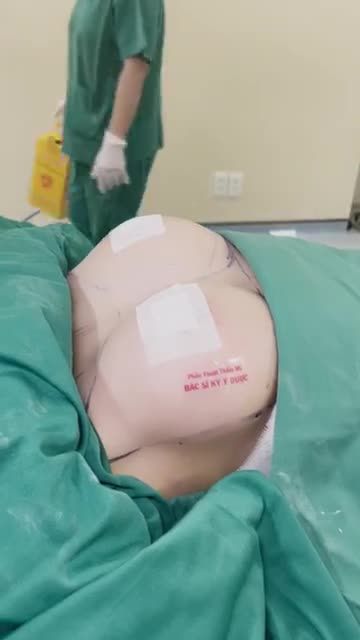 Phẫu thuật được thực hiện tại bệnh viện. CHỈ SAU 60 PHÚT MÀ VÒNG 1 THAY ĐỔI ĐẾN BẤT NGỜ