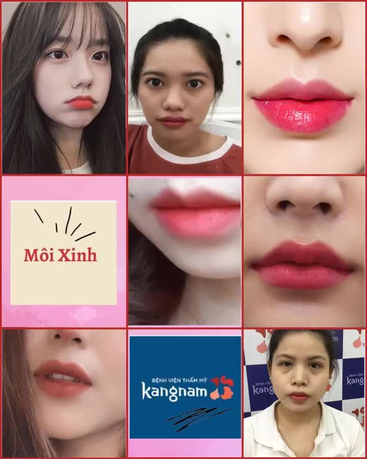 Muốn sở hữu một đôi môi đẹp hãy đến KANGNAM!