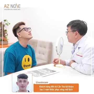 Khách hàng Cần Thơ tái khám sau 5năm khắc phục sóng mũi lệ.ch