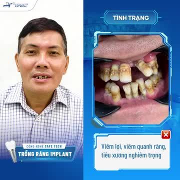"Tuổi đời thì ít nhưng nhìn bên ngoài trông anh như ông lão 60, 70 tuổi. Thật sự rất tự ti..."