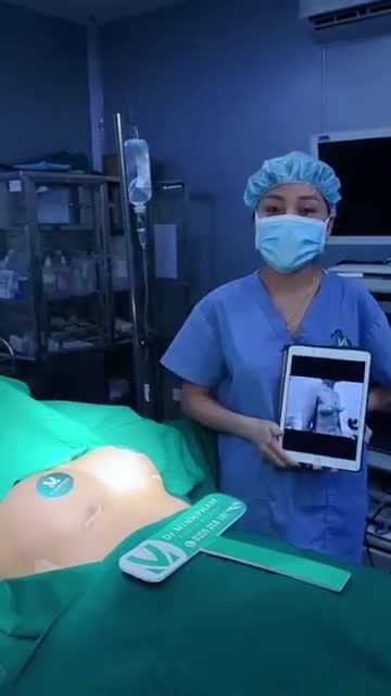 Ca nâng cấp V1 lệch size vừa được thực hiện bởi ekip Dr. Minh Phạm