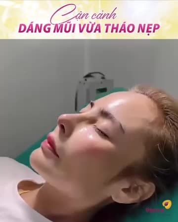 Một nhan sắc mới được nâng tầm sau nâng mũi tại Thiện Mỹ ạ!