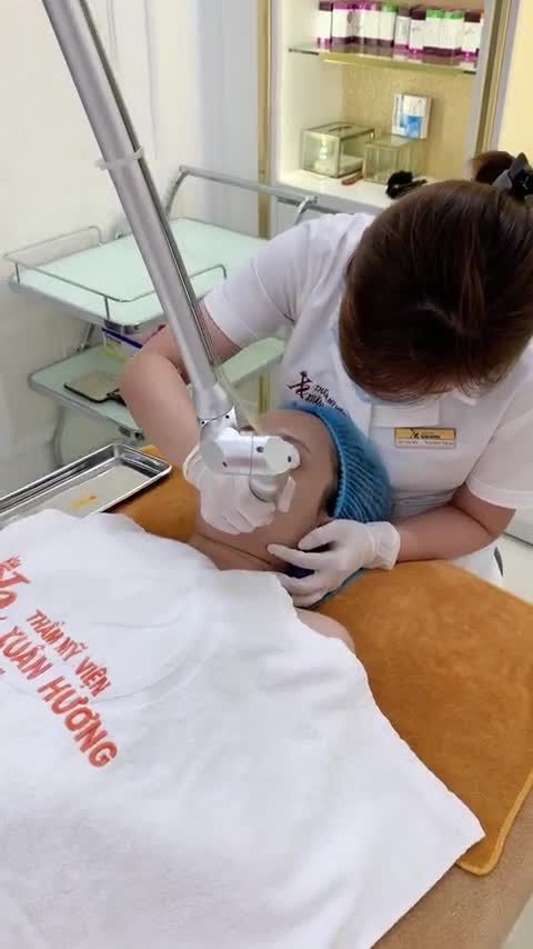 Khách hàng trị nám sau 1 năm quay trở lại tái khám