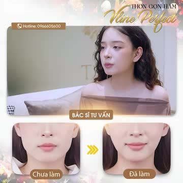 Giải pháp gọn mặt không phẫu thuật, siêu nhanh chóng chỉ 45 phút