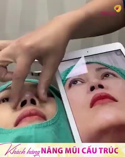 Hé lộ dáng mũi mới nâng của chị KH, quá trời xuất sắc!!!