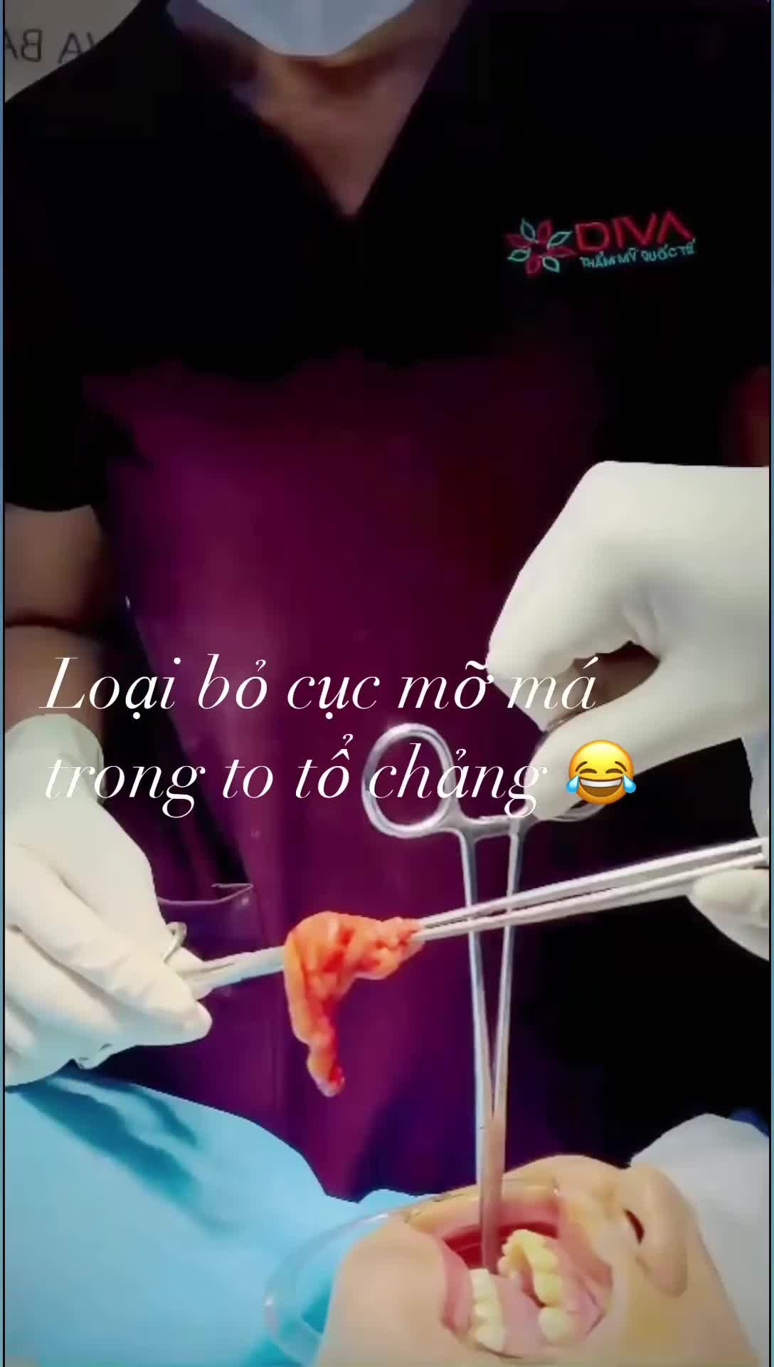 TÚI MỠ MÁ TRONG LÀM GƯƠNG MẶT PHÚNG PHÍNH CHẢY XỆ - ĐỪNG LO HÃY ĐẾN DIVA