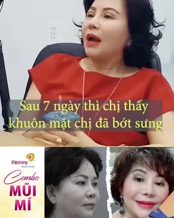 Cô khách sở hữu giao diện mới xinh đẹp và tươi trẻ hơn sau khi thực hiện combo mũi + mí tại VTM Thiện Mỹ.