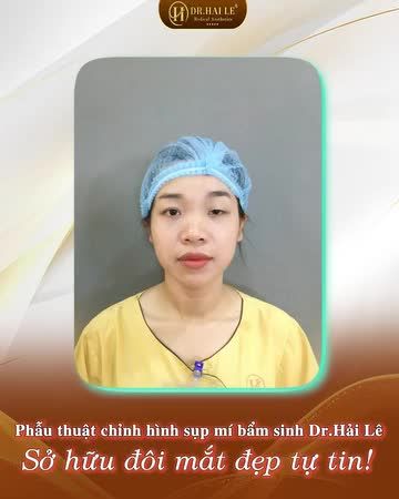 Đằng sau lớp kính râm là đôi mắt với mí sụp, hai mí không đều nhau -Chị em tự ti với diện mạo bản thân...