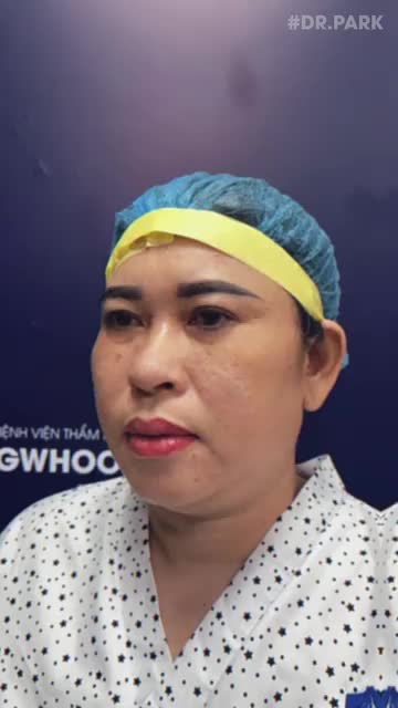 4 ĐIỂM NỔI BẬT NÂNG MŨI CẤU TRÚC CHINH PHỤC THẾ GIỚI