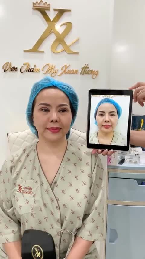 Khách hàng nâng cung mày, cắt mí sau 10 năm quay trở lại Xuân Hương có cảm nhận gì?