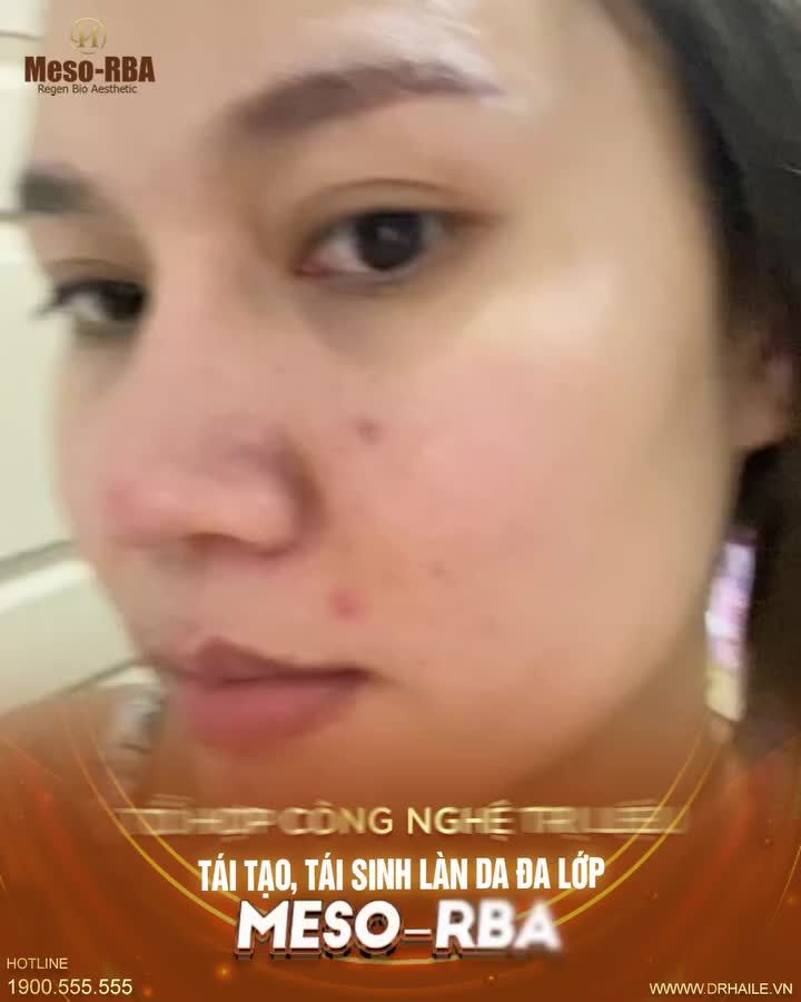 Sở hữu làn da căng, trắng, sáng, bóng, mịn chỉ sau 1 liệu trình!
