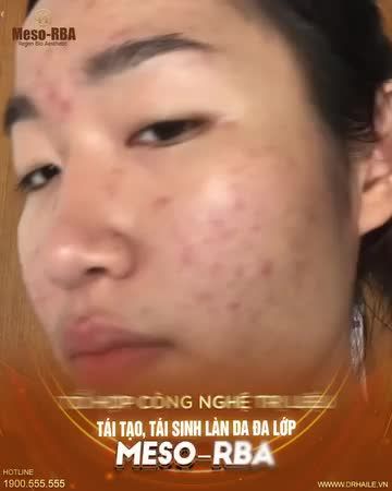 Xứng danh phương pháp làm đẹp "toàn năng", được hàng ngàn chị em tin tưởng lựa chọn!