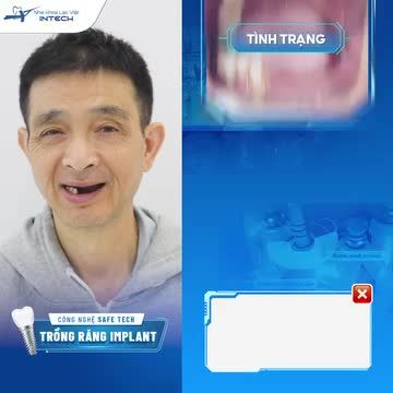 Hơn 10 năm nay, chú Lê Văn Tĩnh (63 tuổi) gặp tình trạng mất nhiều răng toàn hai hàm do ảnh hưởng của bệnh lý răng miệng.