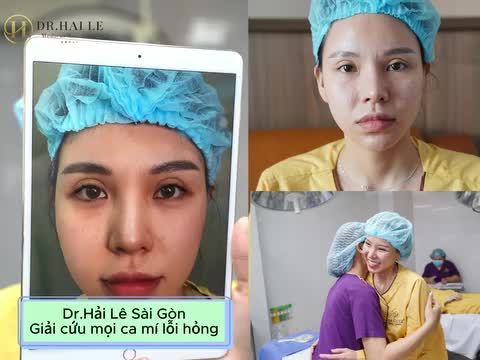 Sống chung với đôi mắt lỗi hỏng 6 năm và 6 năm qua Phương Trinh đã phải sống một cuộc sống như thế nào? Cùng Dr.Hải Lê lắng nghe tâm sự của bạn ấy nhé cả nhà!
