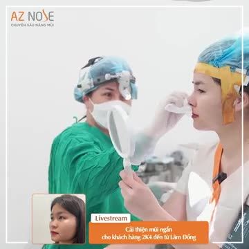Bác sĩ CKI. Hoàng Nhung khắc phục mũi ng.ắn, th.ấp cho khách hàng 2K4 đến từ Lâm Đồng.