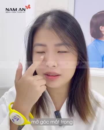 Đôi mắt to tròn - Tự tin giao tiếp  - Cắt mí chỉ còn 6800K