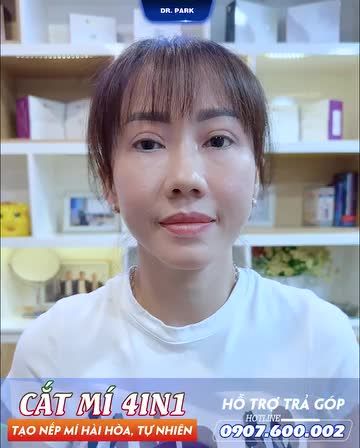 ƯU ĐIỂM CẮT MÍ 4 TRONG 1 (PLASMA)