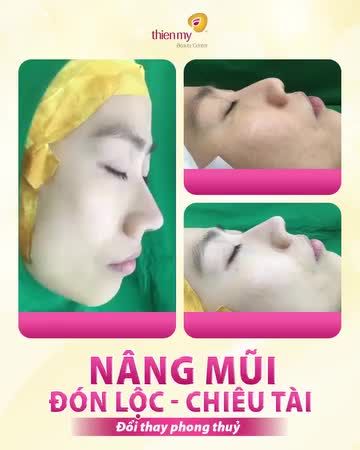 TIN TƯỞNG BÁC SĨ THIỆN – CHỊ EM NHẬN ĐƯỢC DÁNG MŨI ƯNG Ý