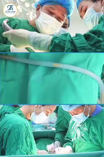 60P TRÚT SẠCH MỠ THỪA CÙNG CÔNG NGHỆ LIPO MATIC 3D