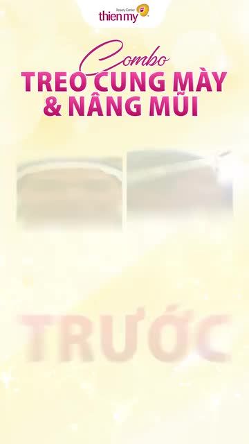 Nhan sắc rạng rỡ của KH sau khi thực hiện combo treo chân mày + Nâng Mũi