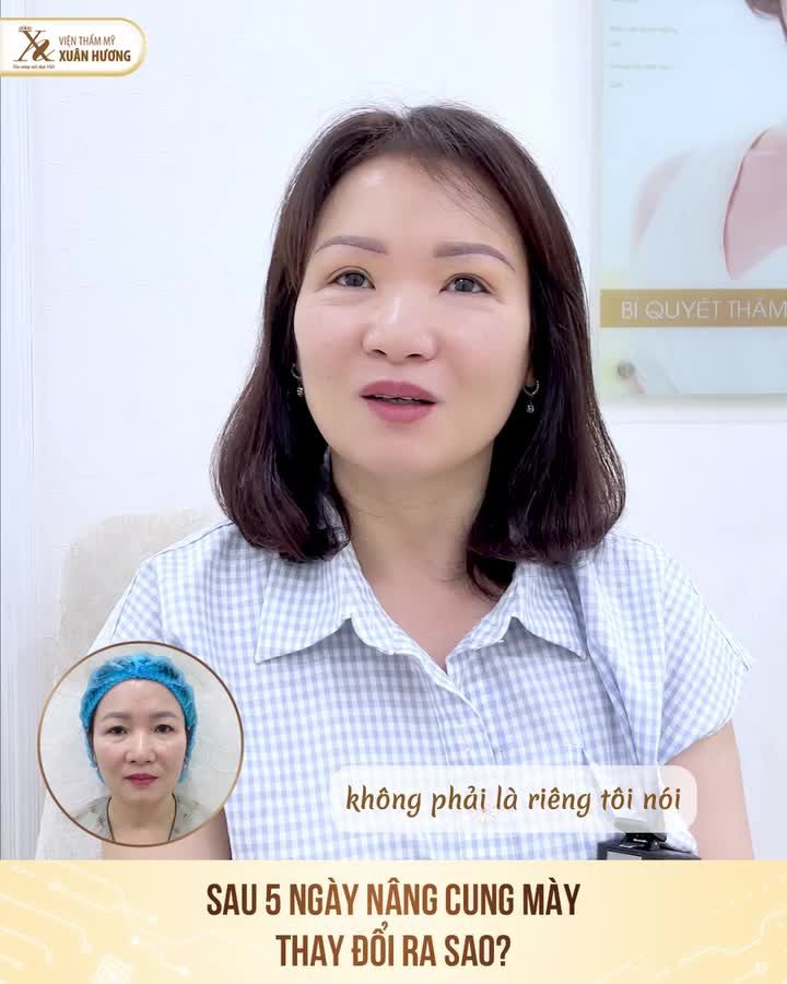 cảm nhận của khách hàng sau 5 ngày nâng cung mày tại VTM Xuân Hương. Chỉ sau 40 phút: