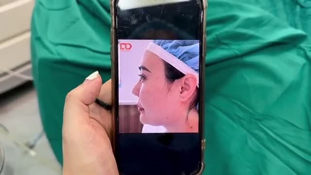 Đã có kết quả ca cấy mỡ toàn mặt hoa hậu Kim Oanh. Chị em đã chuẩn bị sẵn sàng tinh thần để "ngắm" chưa ạ?