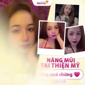 NGẮM NHÌN FORM DÁNG MŨI SIÊU XINH KHÁCH HÀNG TẠI THIỆN MỸ