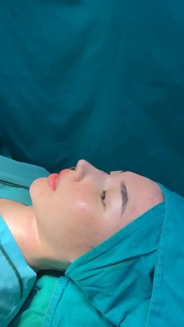 Case mũi cấu trúc vừa hoàn thành