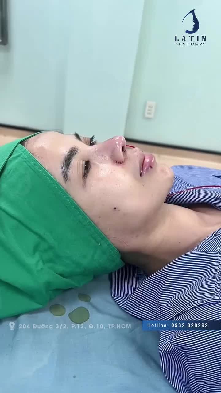 Được bạn thân giới thiệu, chị P đến từ Campuchia dù không biết tiếng Việt nhưng vẫn quyết tâm sang Việt Nam thay đổi dáng mũi mới.