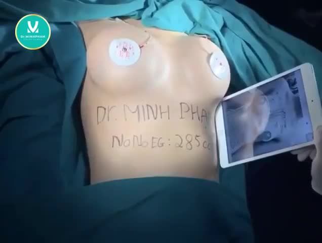 THÁNG NÀY NÂNG CẤP V1 TẶNG NGAY ÁO ĐỊNH HÌNH