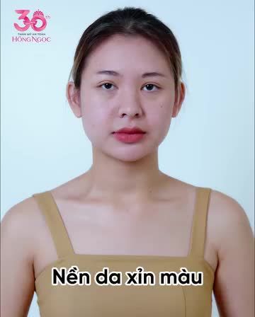 TỰ TIN LÀ PHIÊN BẢN HOÀN HẢO VỚI MESO PERFECT FACE