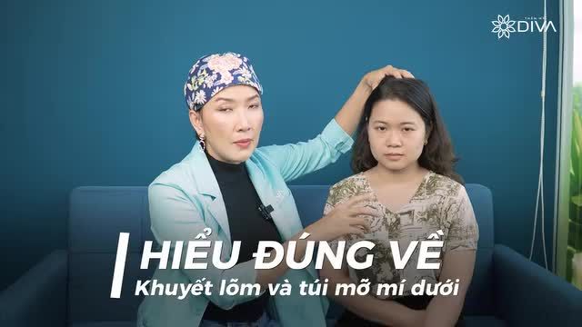 KHUYẾT LÕM VÀ TÚI MỠ MÍ MẮT DƯỚI – CÁCH KHẮC PHỤC HIỆU QUẢ
