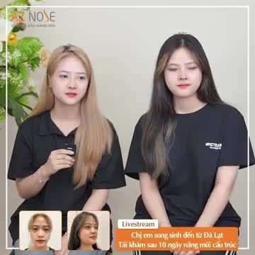 Chị em song sinh đến từ Đà Lạt tái khám sau 10 ngày nâng mũi cấu trúc