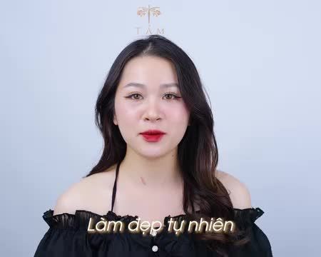Chỉ cần 30 phút để hoàn thiện khuyết điểm nhan sắc, sở hữu gương mặt đẹp chuẩn mực với Filler tại Tấm.