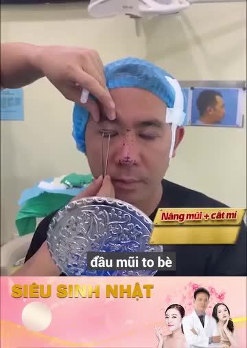NHẬP HỘI MŨI CAO, MÍ ĐẸP VỚI ƯU ĐÃI CỰC HỜI