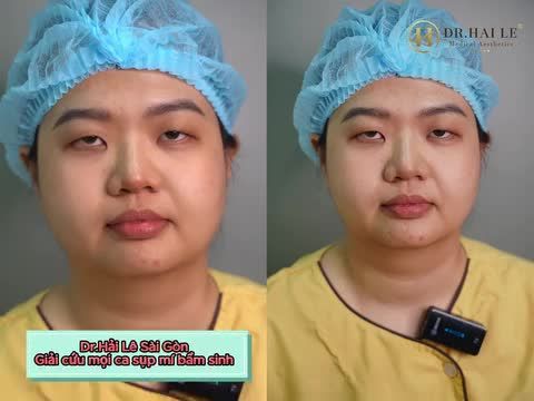 36 năm sống chung với đôi mắt "ai cũng ch.ê" tôi thật sự rất buồn và tự ti Cùng lắng nghe câu chuyện của vị khách hàng sinh ra đã không có được đôi mắt như bao người bình thường và chặng đường giúp bản thân tự tin hơn như thế nào???