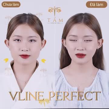 VLINE PERFECT - THẦN THÁI CAO SANG CUỐN HÚT