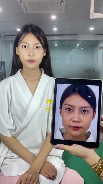 Ca Vline Perfect quay lại tái khám tại TMV Tấm