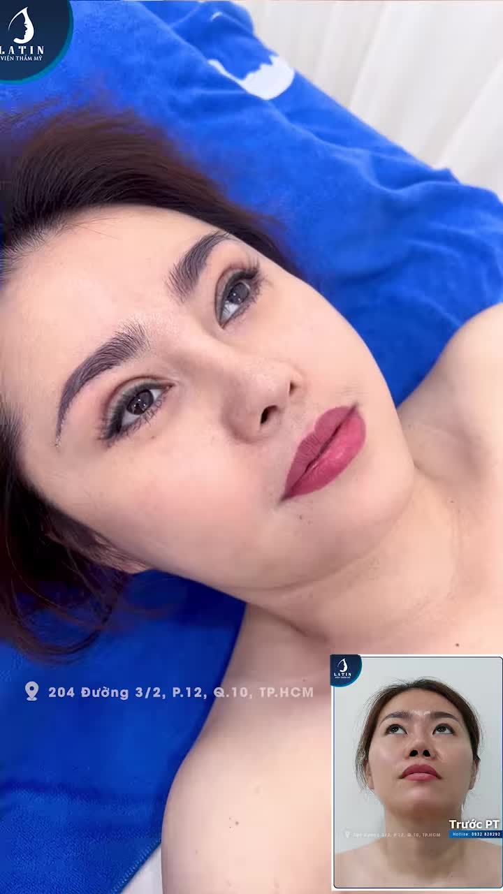 Khách hàng ở xa tái khám trước khi quay về nước