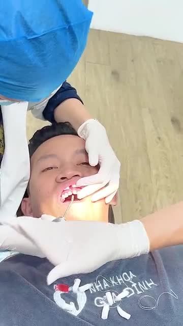 QUÁ TRÌNH LẮP 21 RĂNG SỨ LAVA ESTHETIC CHO NAM KHÁCH HÀNG PHONG ĐỘ, LỊCH LÃM
