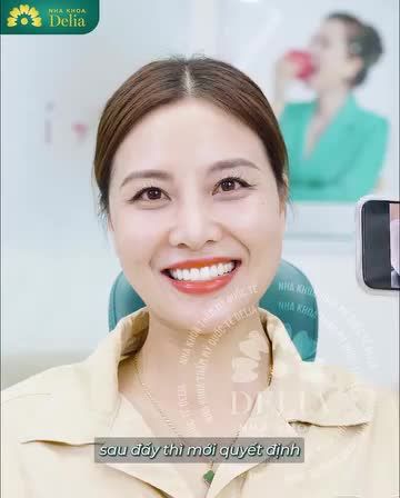 Cùng Delia ngắm nhìn sự thay đổi nụ cười của chị Lệ và nghe thêm những chia sẻ của chị về nụ cười này trong video nhé!